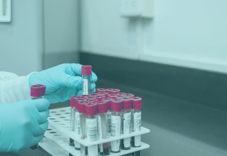 PCR-testi ei riitä diagnoosin tekoon.